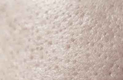 PORES